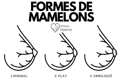 mamelons-schema-normal-plat-ombilique